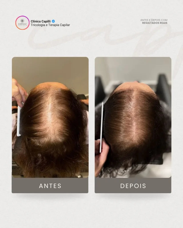 dermatologista de cabelo