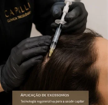 exossomos capilar