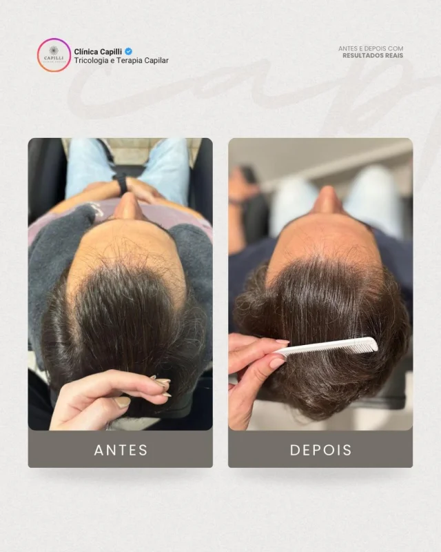 mmp para cabelo