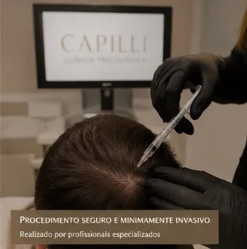 regeneração capilar com exossomos