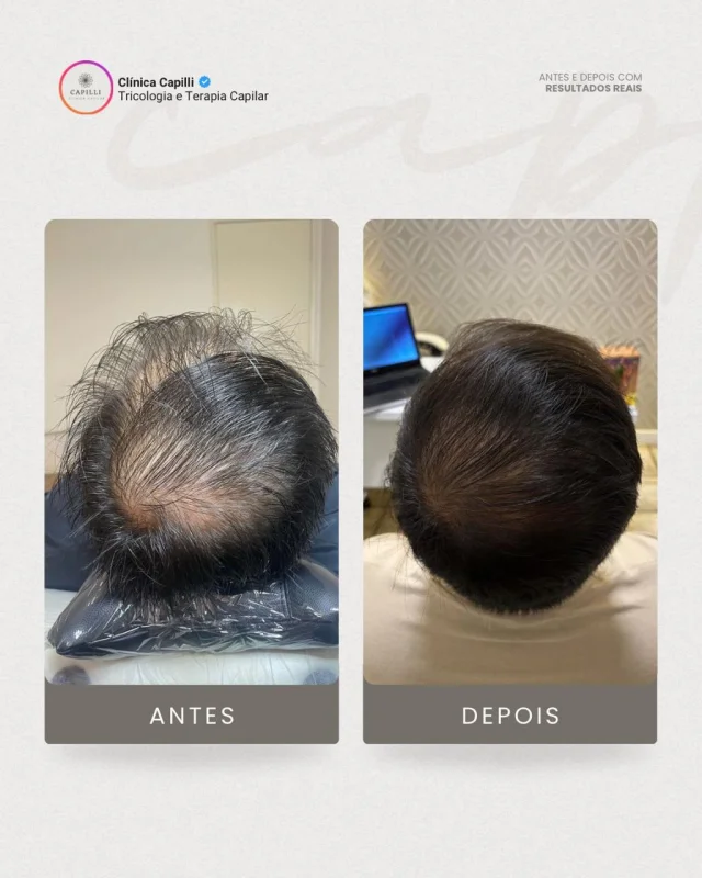 tratamento mmp
